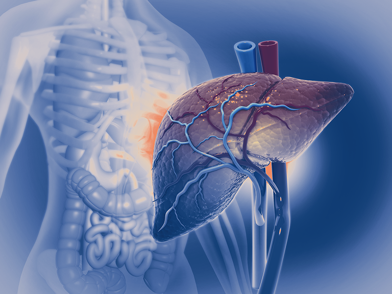 Liver & Bile Duct Cancer: Challenges, Diagnosis & Care