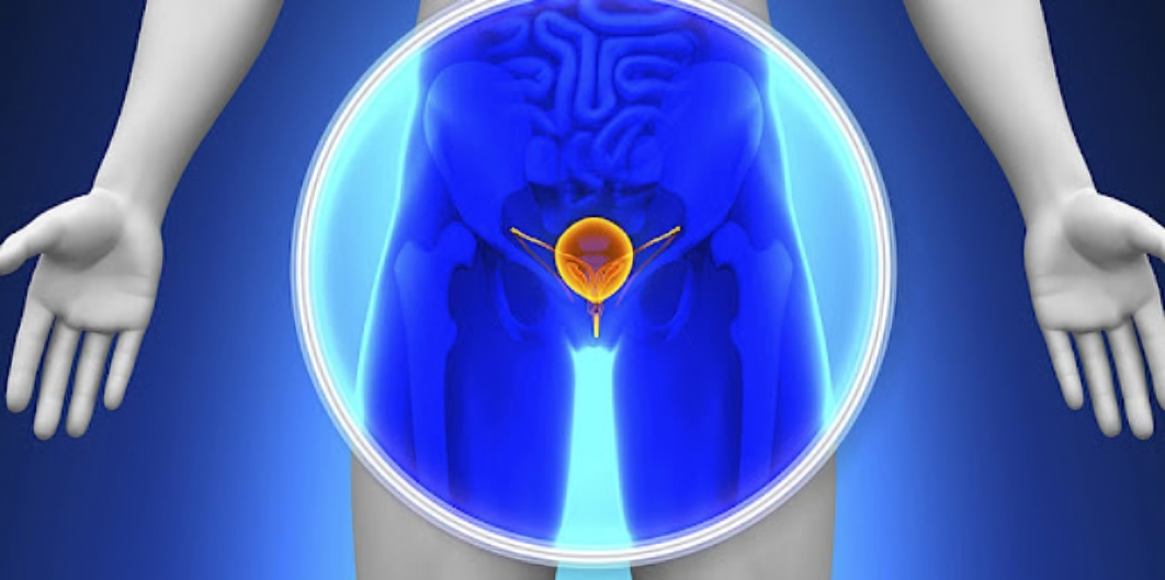 Urological Cancer: Signs, Diagnosis & Treatment Insights