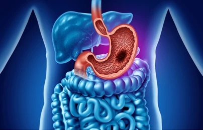 Gastrointestinal-Cancer-Treatment