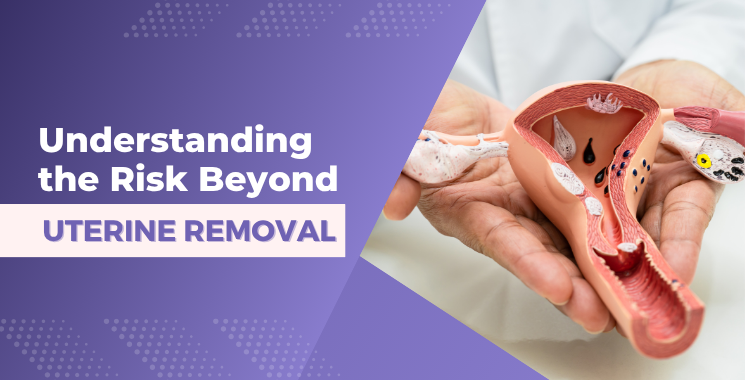 Ulterine-Removal-Blog-Banner