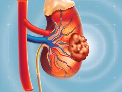 head and neck cancer surgery